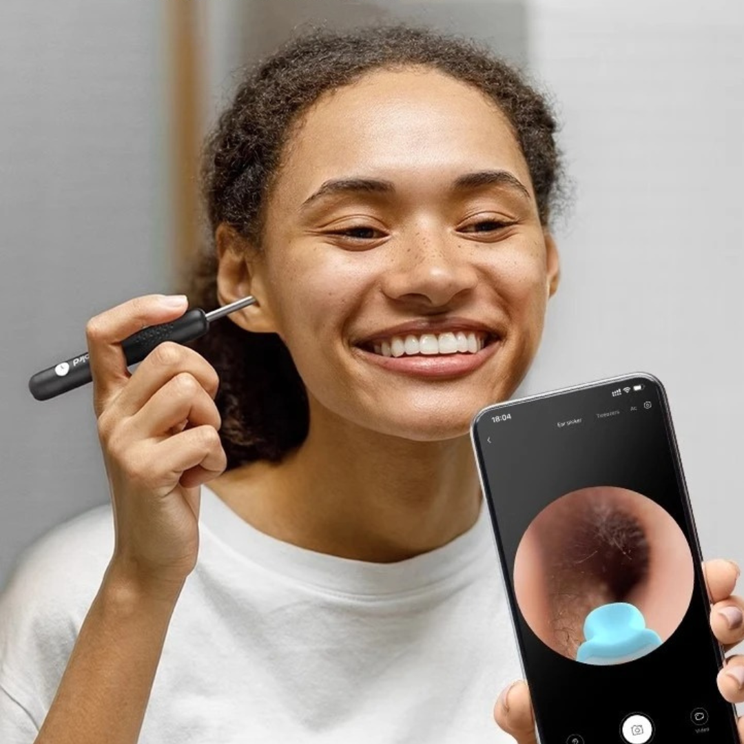Kit Limpiador de Oídos con Cámara 4K – La forma segura de eliminar la cera y prevenir infecciones
