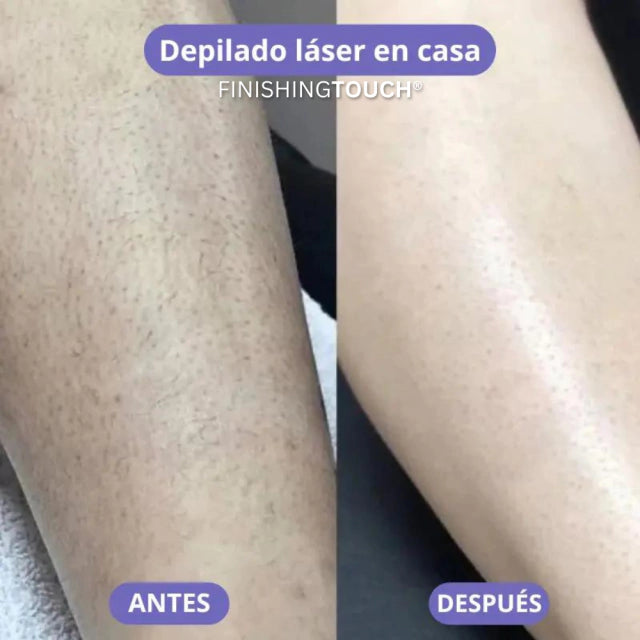 Depiladora laser FINISHING TOUCH® (2025) | inalámbrica y recargable ✨