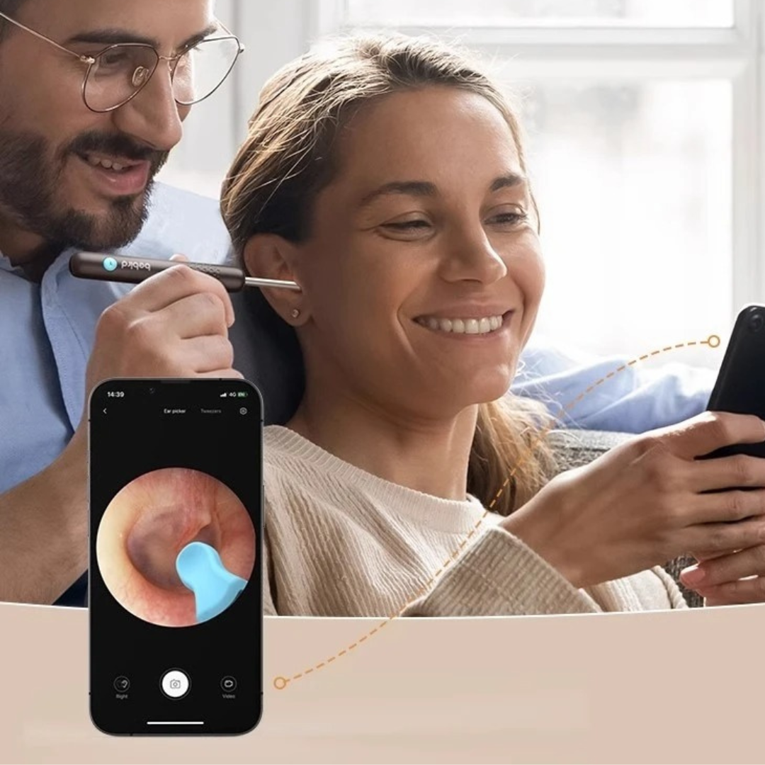 Kit Limpiador de Oídos con Cámara 4K – La forma segura de eliminar la cera y prevenir infecciones